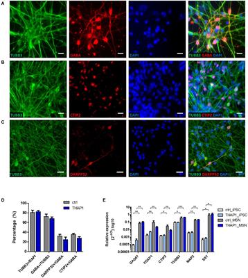 Reduced Expression of GABAA Receptor Alpha2 Subunit Is Associated With Disinhibition of DYT-THAP1 Dystonia Patient-Derived Striatal Medium Spiny Neurons